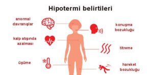 Read more about the article Hipotermi nedir?
